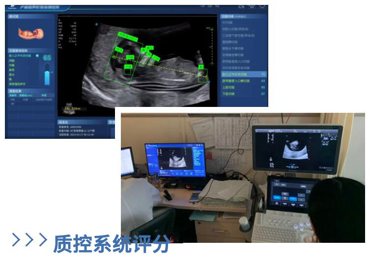 第一期早孕期规范化超声筛查手把手培训班顺利举行-10-s.jpg