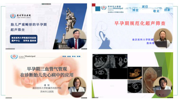 第一期早孕期规范化超声筛查手把手培训班顺利举行-12-s.jpg